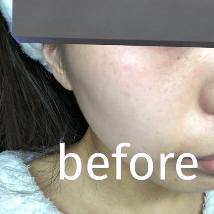 ゼン ウェア フルイド/DECORTÉ/リキッドファンデーションを使ったクチコミ(2枚目)