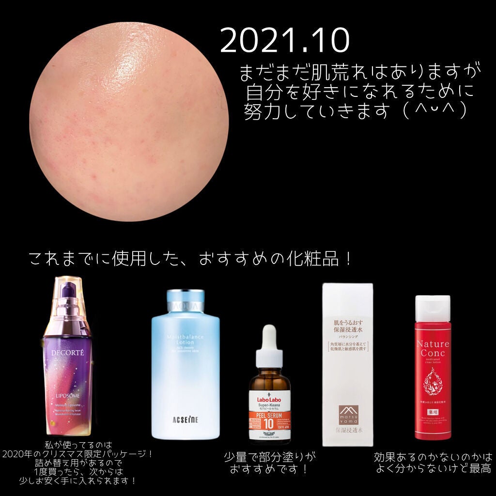 モイストバランス ローション/ACSEINE/化粧水を使ったクチコミ(8枚目)