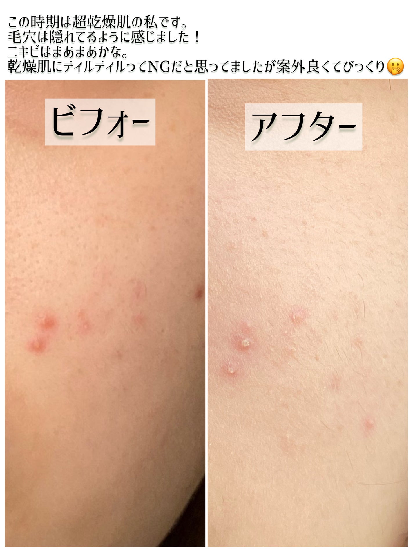 マスクフィットオーラクッション/TIRTIR(ティルティル)/クッションファンデーションを使ったクチコミ(4枚目)