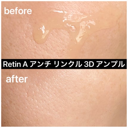 Retin A アンチ リンクル3Dクリーム/theralogic/フェイスクリームを使ったクチコミ(4枚目)