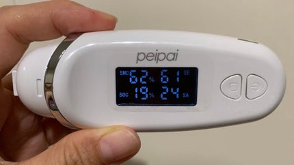 W.H.P ブラックマスク JEX/MEDIHEAL/シートマスク・パックを使ったクチコミ(5枚目)