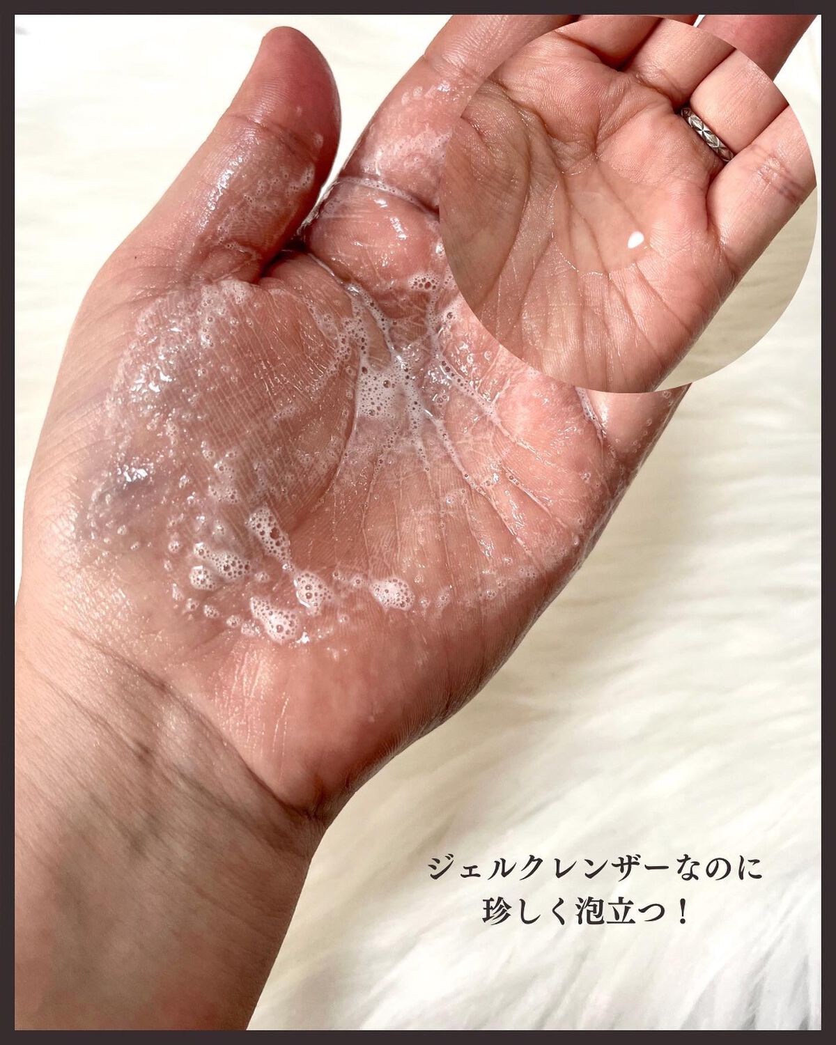 フィトジェンウルトラ パーフェクトアンプル /Anestee/美容液を使ったクチコミ(3枚目)