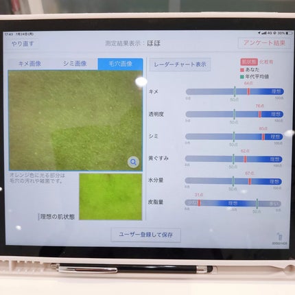 肌遺伝子検査キット MY SKIN ID/MY SKIN ID/遺伝子検査キットを使ったクチコミ(8枚目)