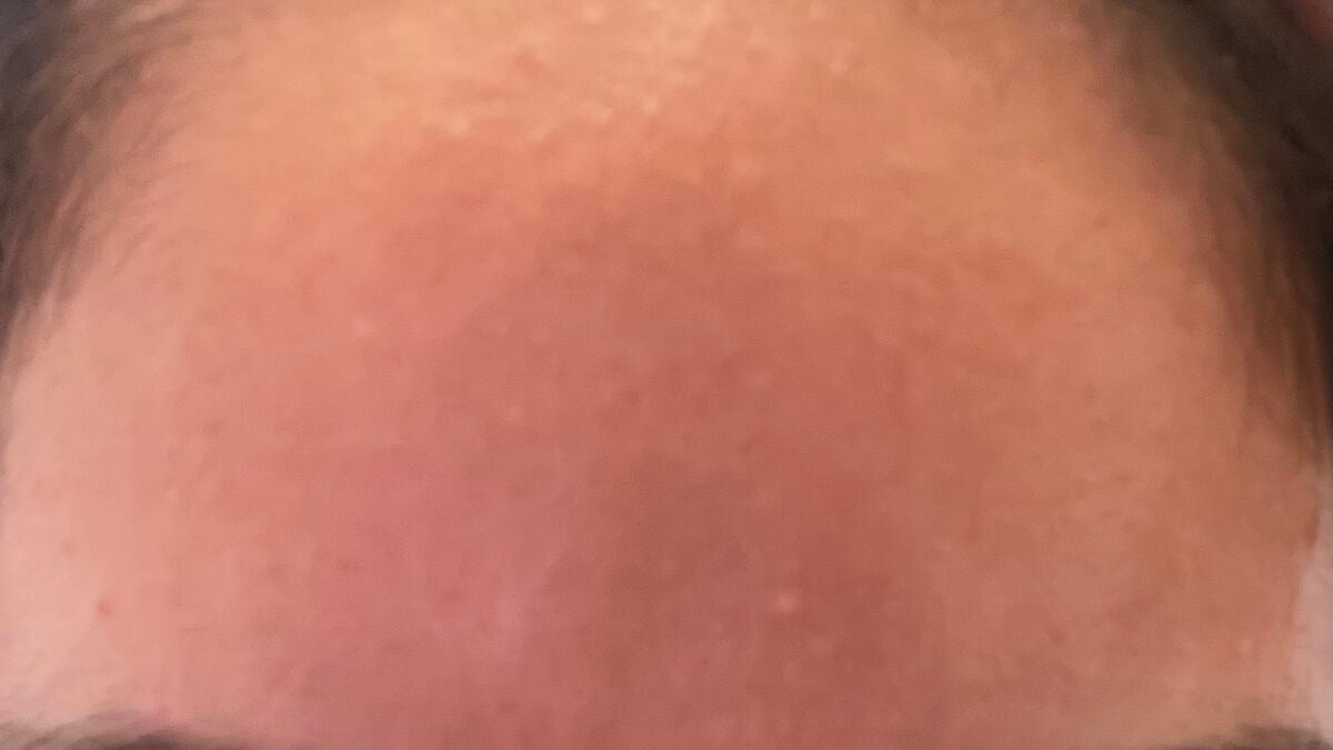 ハトムギ化粧水(ナチュリエ スキンコンディショナー R )/ナチュリエ/化粧水を使ったクチコミ(5枚目)