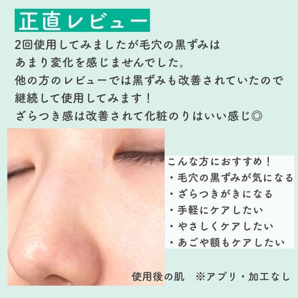 ポアゼロクリアジェル/BRTC/ピーリングを使ったクチコミ(4枚目)