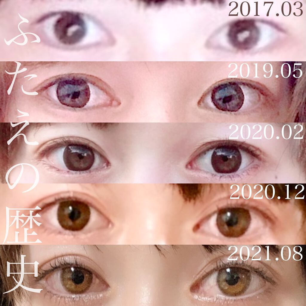 tobibi on LIPS 「2年半で目元はここまで垢抜けられる!/私の二重幅の広げ方とくせ..」(2枚目)