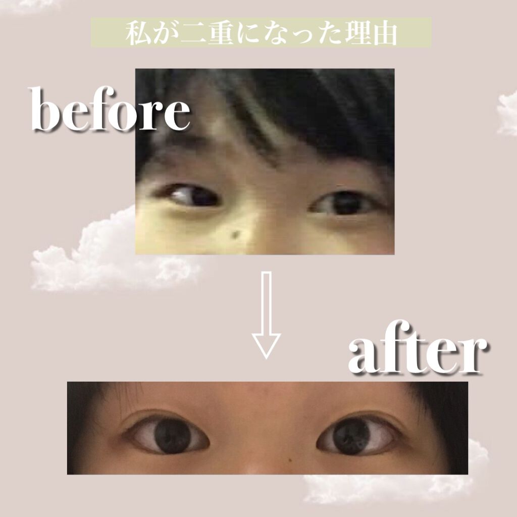 リアルダブルアイリッド/K-パレット/二重まぶた用アイテムを使ったクチコミ(2枚目)