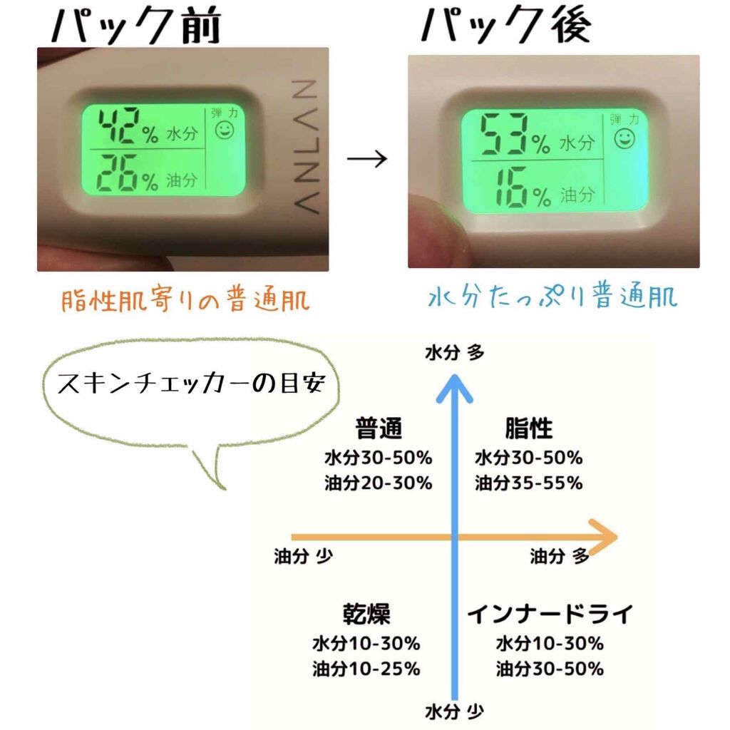 Updating Mask 1.0.0 5タイプセット 1セット5枚入り/meol/シートマスク・パックを使ったクチコミ(4枚目)