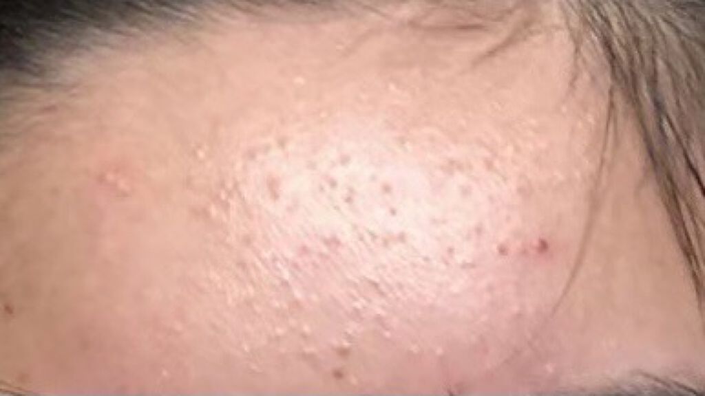 バランス スキンコンディショナー/RMK/化粧水を使ったクチコミ（2枚目）