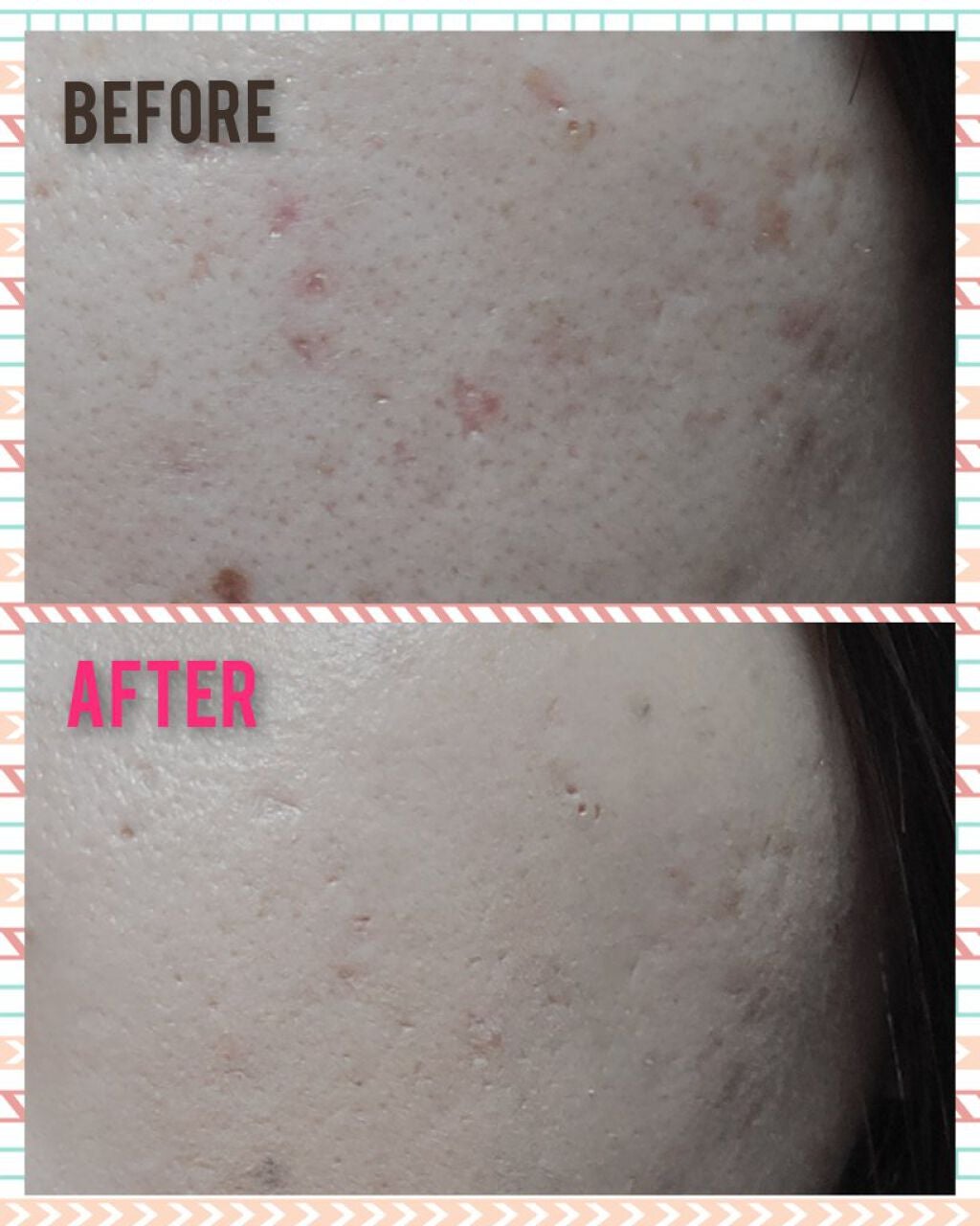 フィットミー リキッドファンデーション R/MAYBELLINE NEW YORK/リキッドファンデーションを使ったクチコミ(3枚目)