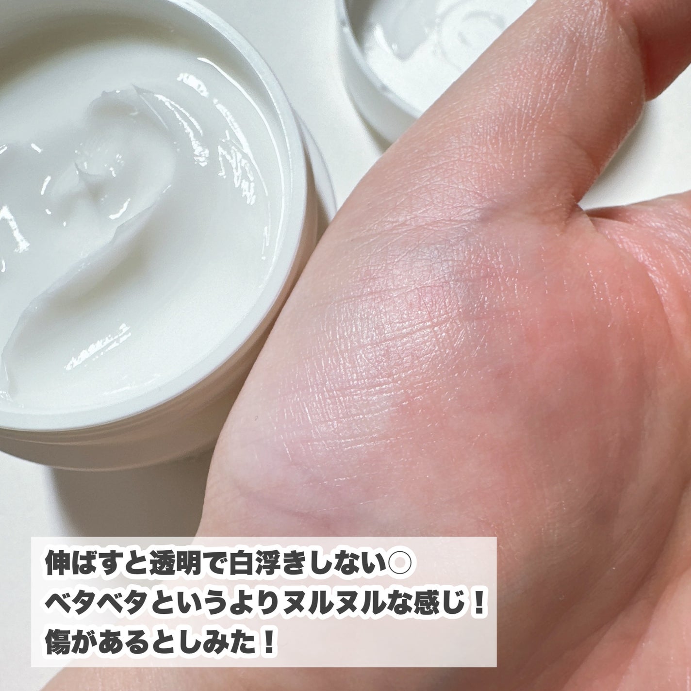 U20クリーム(医薬品)/メンターム/その他を使ったクチコミ(4枚目)