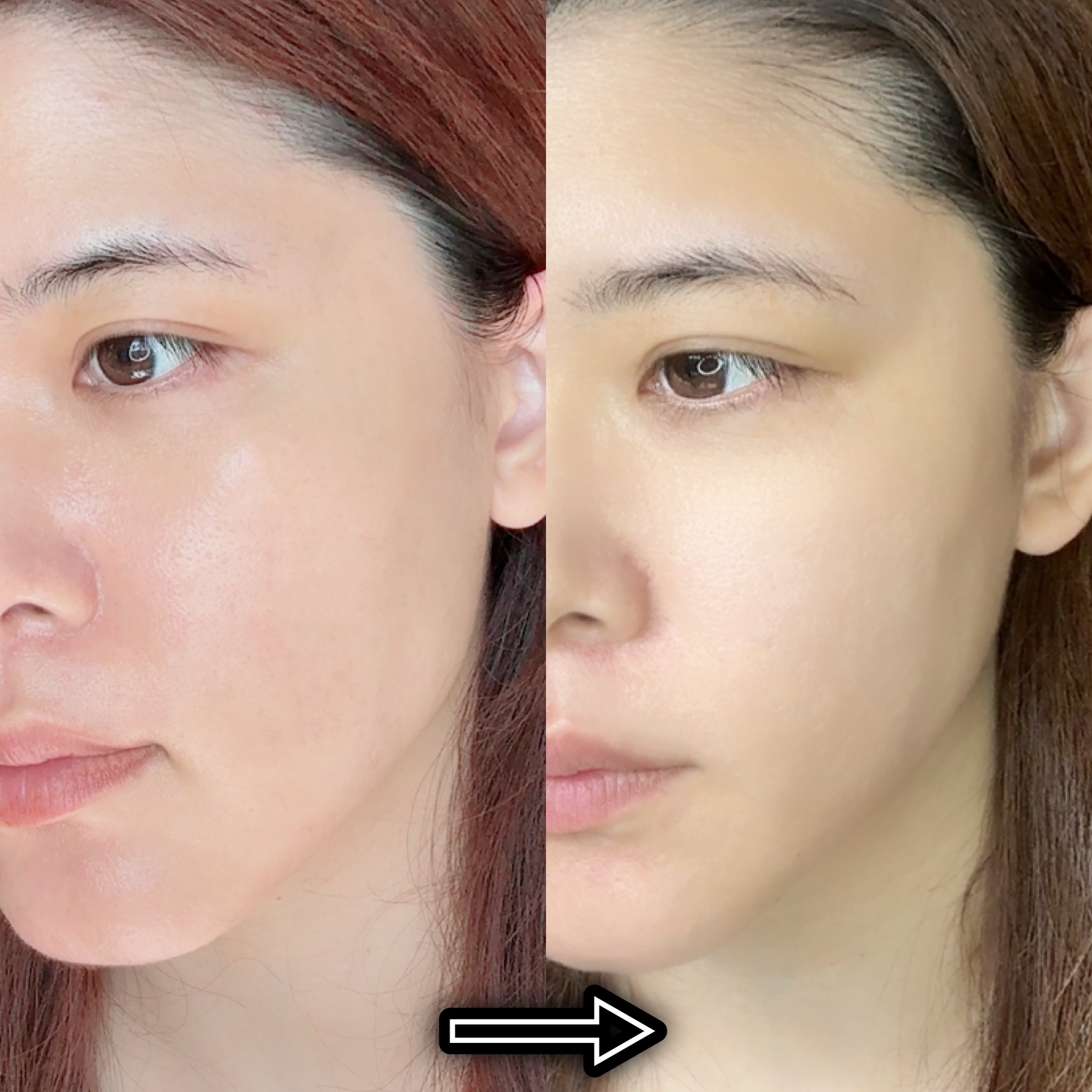 9番 NMNバイオリフト濃縮美容液｜numbuzinの口コミ - ナンバーズ