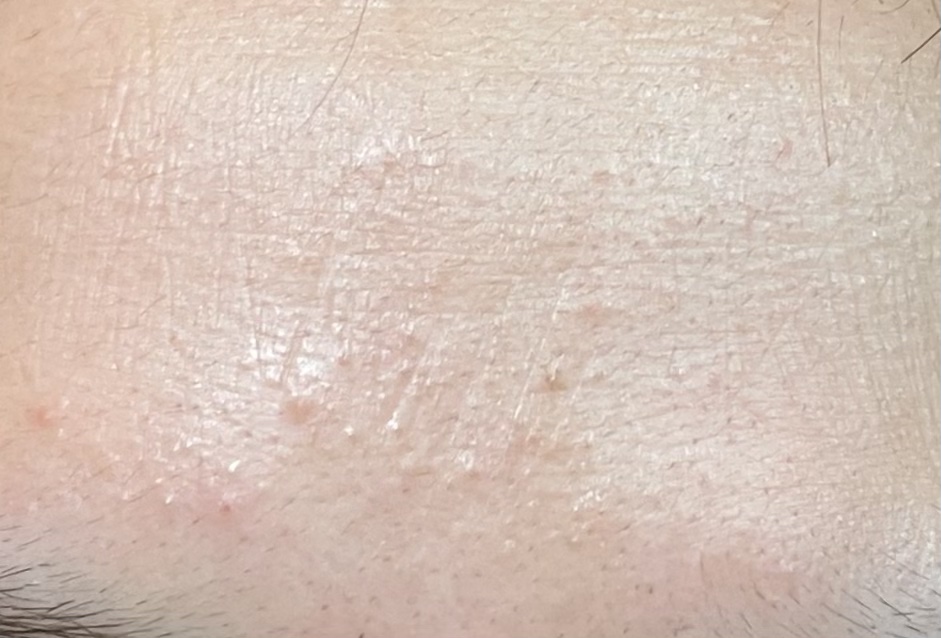 ビタミンC誘導体配合化粧水/ナリス化粧品/化粧水を使ったクチコミ（3枚目）