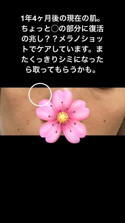 メラノショット W/ONE BY KOSE/美容液を使ったクチコミ(5枚目)