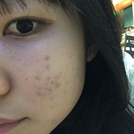 モイスチュア ローション/カルテHD/化粧水を使ったクチコミ(2枚目)