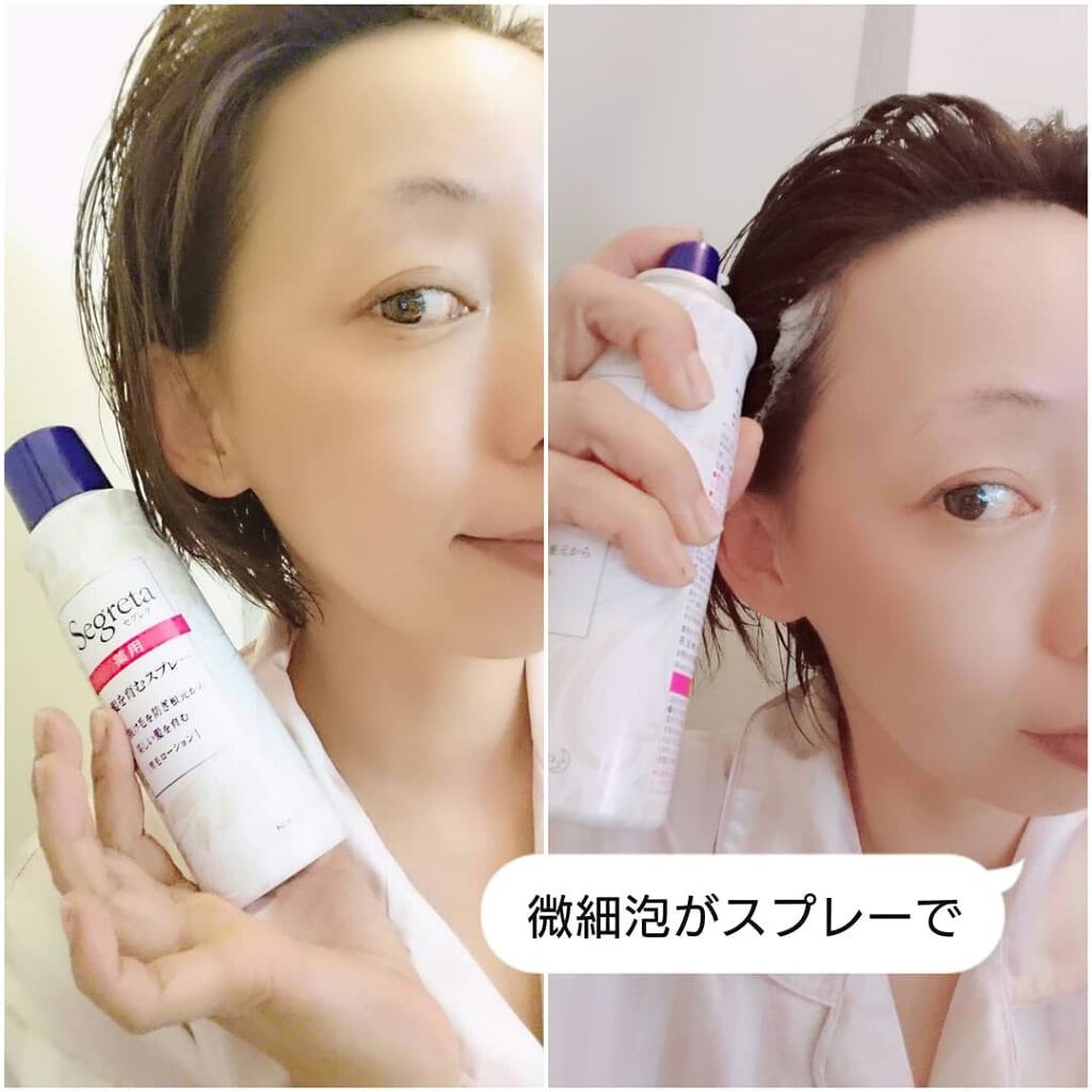 髪を育むスプレー/セグレタ/頭皮ローションを使ったクチコミ(2枚目)