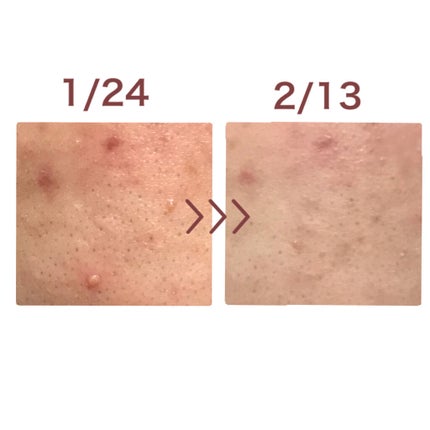 CICA デイリースージングマスク/VT/シートマスク・パックを使ったクチコミ(3枚目)