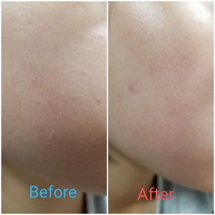 純白専科 すっぴん色づく美容液フォンデュ/SENKA(専科)/リキッドファンデーションを使ったクチコミ(2枚目)