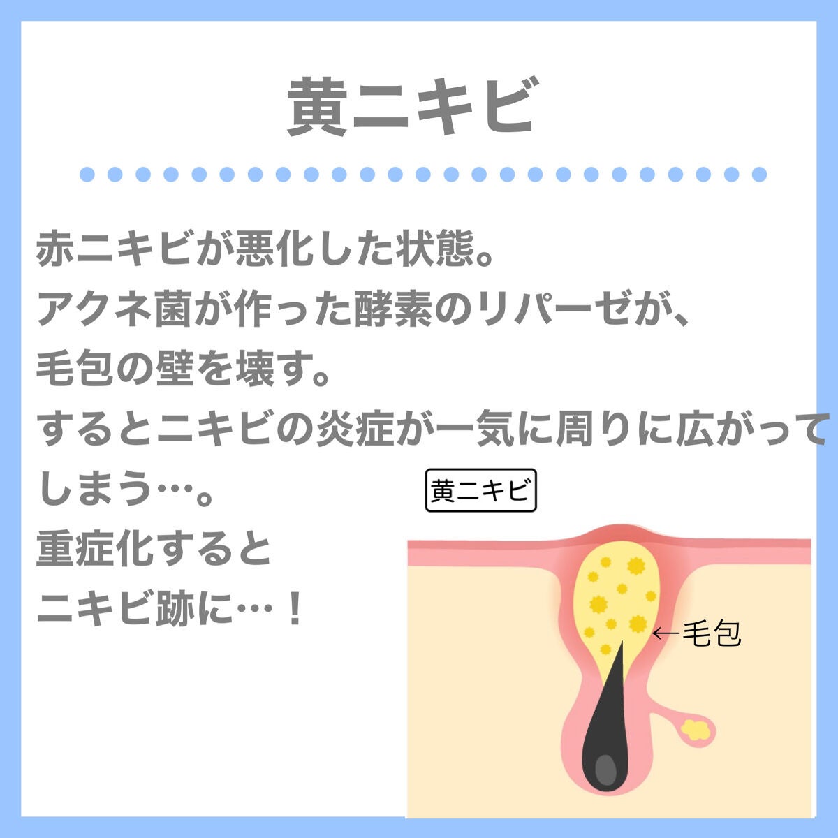 çŽã
ðžãã©ãã100(æçš¿ããæ¹) on LIPS ããããæ²æ»
ããã«ã¯ãŸããããã®ç¹åŸŽãç¥ããšããããšã§ããããšã¯..ãïŒ7æç®ïŒ