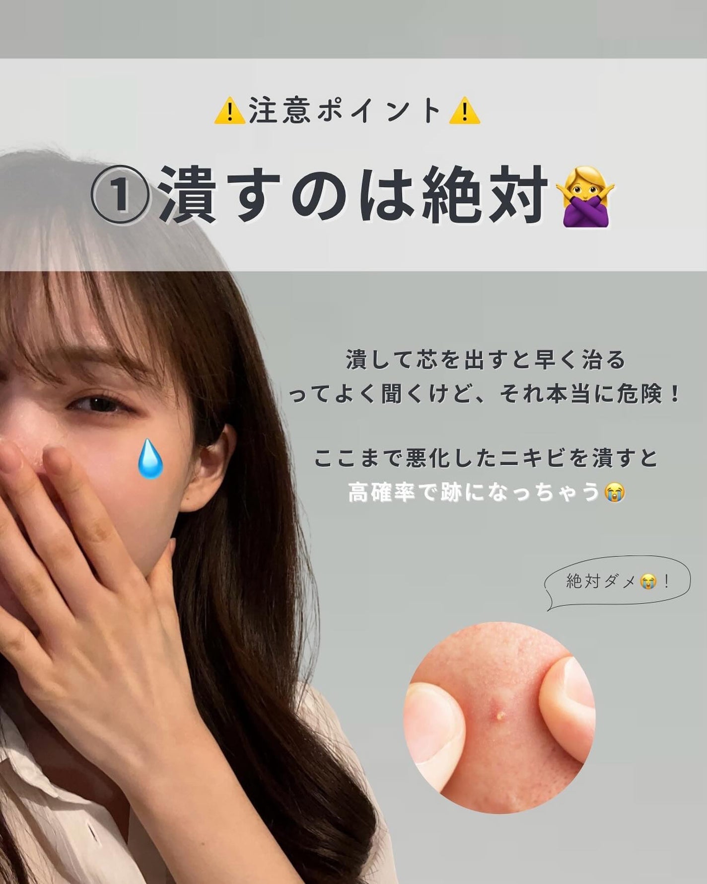 白湯(サユ) | ニキビと戦うOL🤍 on LIPS 「黄ニキビ一生繰り返してる😭😭って人集合!ありえないくらい目立..」(3枚目)