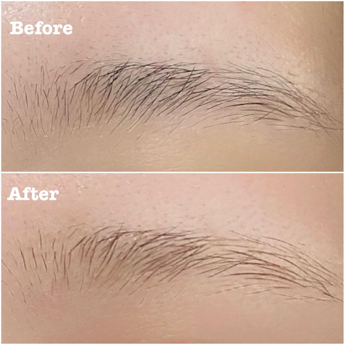 ジョレン クリーム ブリーチ/ジョレンジャパン/ムダ毛ケアを使ったクチコミ（3枚目）