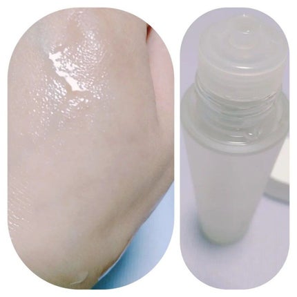 オルビスユー ローション/オルビス/化粧水を使ったクチコミ(4枚目)