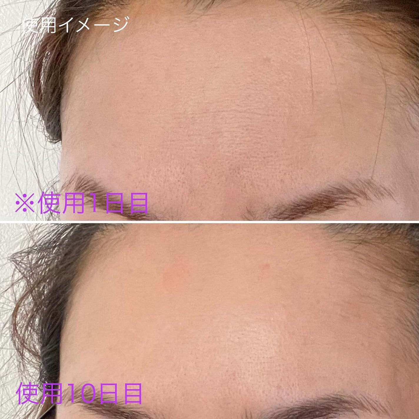 ダーマアンサー PDRN アクティブブースト1:1アンプル/CNP Laboratory/美容液を使ったクチコミ(8枚目)