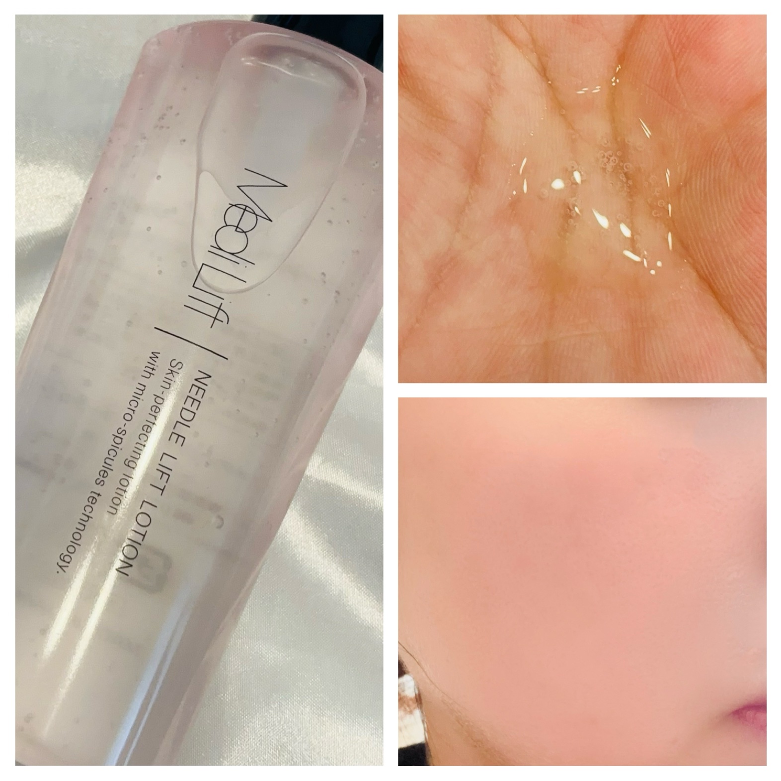 メディリフト ニードルリフトローション/YA-MAN TOKYO JAPAN/化粧水を使ったクチコミ（2枚目）