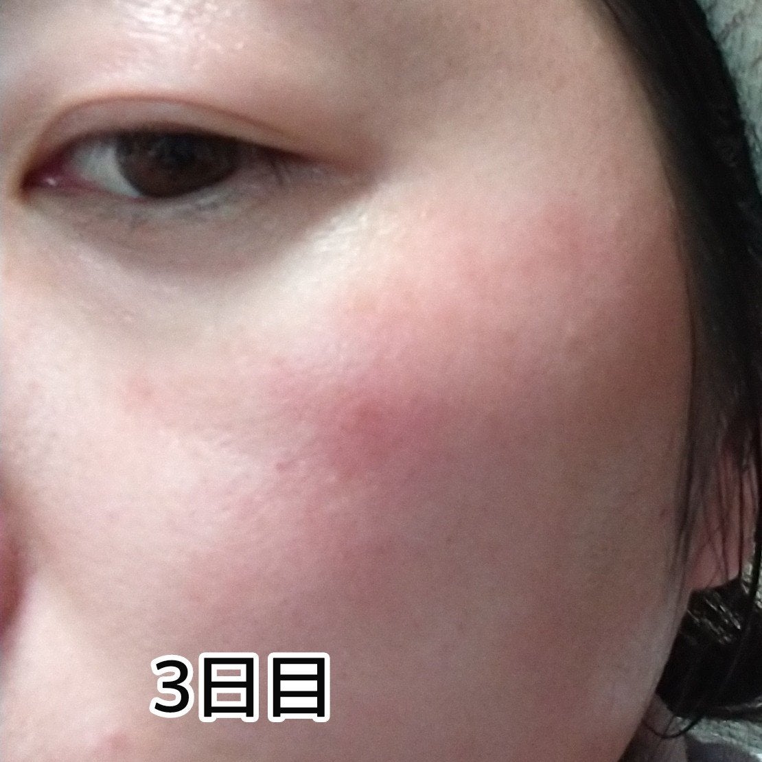 ヨナ フォロバ100 on LIPS 「MARKAIDハイドスピキュールクリーム15g使用して4日経ち..」(3枚目)