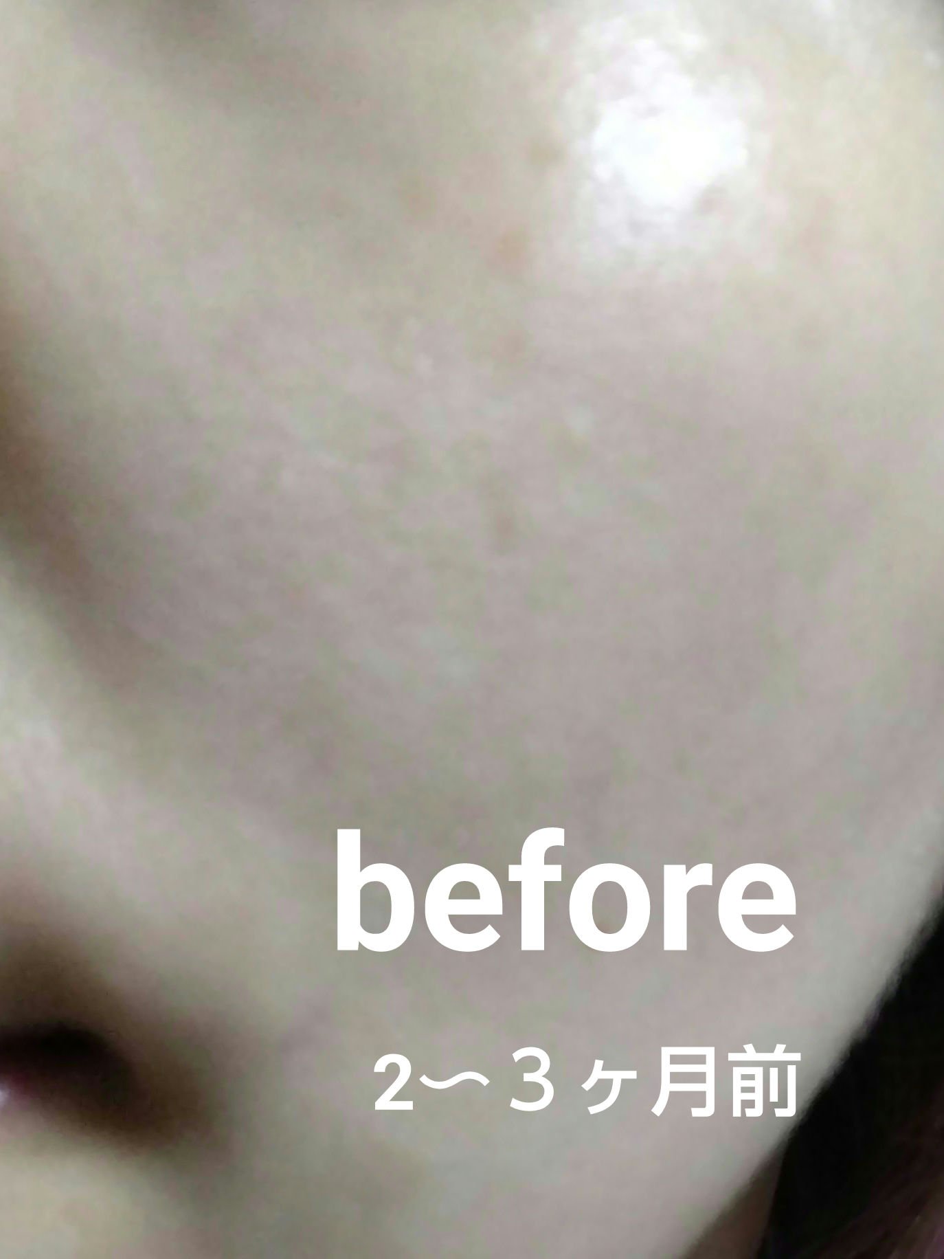 ホワイトニングエッセンス ボトル入り(28ml)/オルビス/美容液を使ったクチコミ（3枚目）