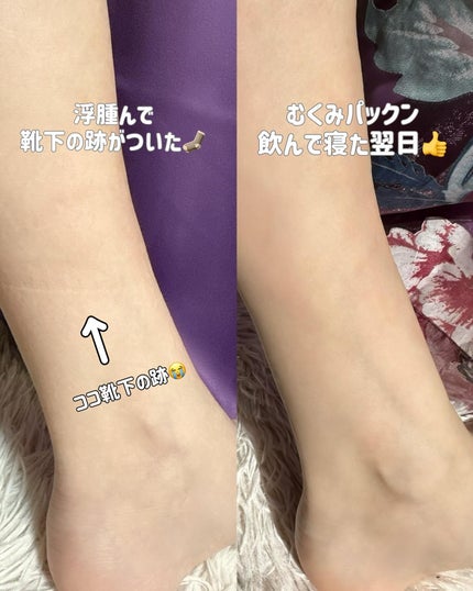 むくみぱっくん パックマンコラボ 42粒/スベルティ/健康サプリメントの画像