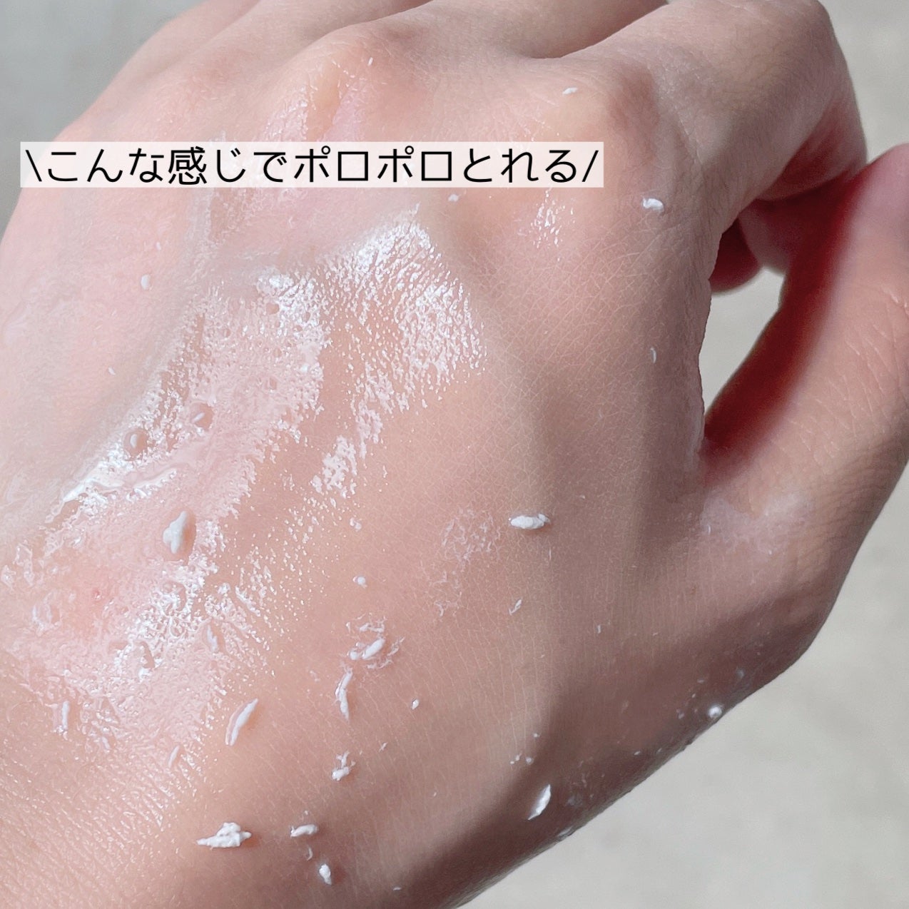 薬用アクネ角質ケアジェル/NIKI PITA/ピーリングを使ったクチコミ(2枚目)