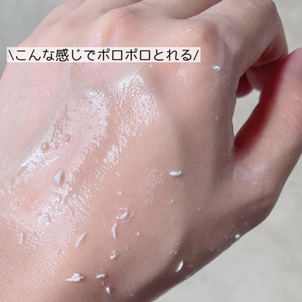 薬用アクネ角質ケアジェル/NIKI PITA/ピーリングを使ったクチコミ(2枚目)