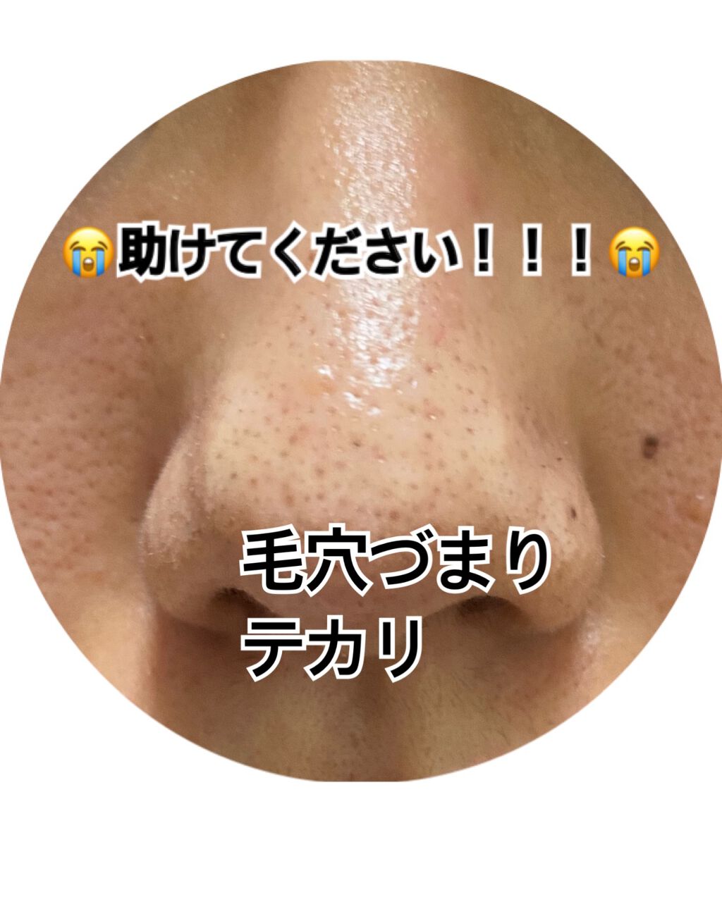 クラリファイング ローション 2/CLINIQUE/拭き取り化粧水を使ったクチコミ（1枚目）