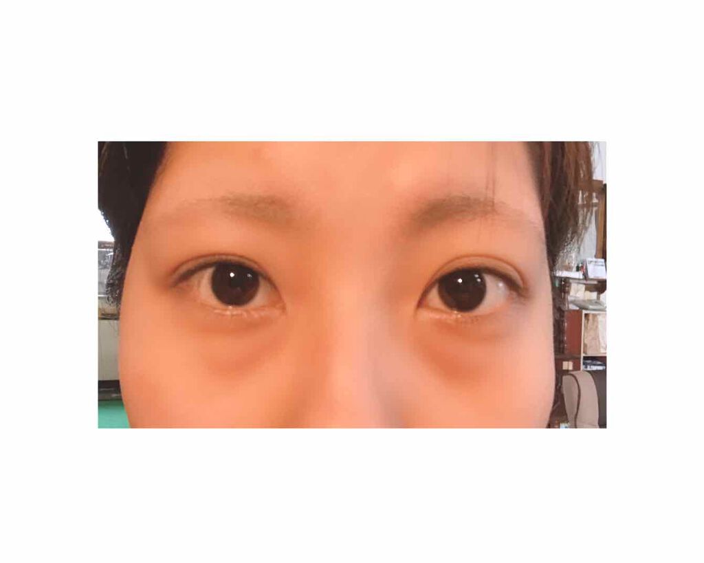 清水@神あゆ on LIPS 「メルカリで売ってる二重ファイバーです!最近、これが使いやすくて..」(2枚目)