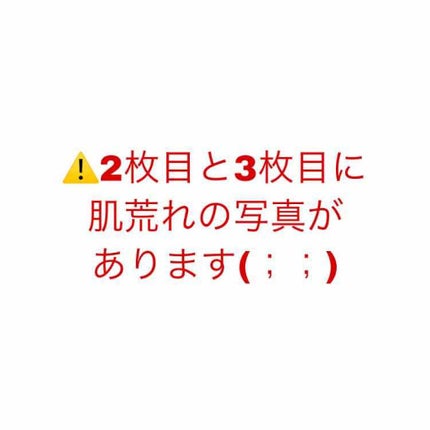 薬用保湿化粧水/オードムーゲ/化粧水を使ったクチコミ(1枚目)