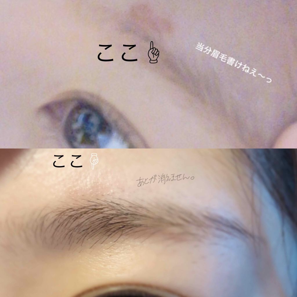 脱色クリーム スピーディー/エピラット/ムダ毛ケアを使ったクチコミ(2枚目)