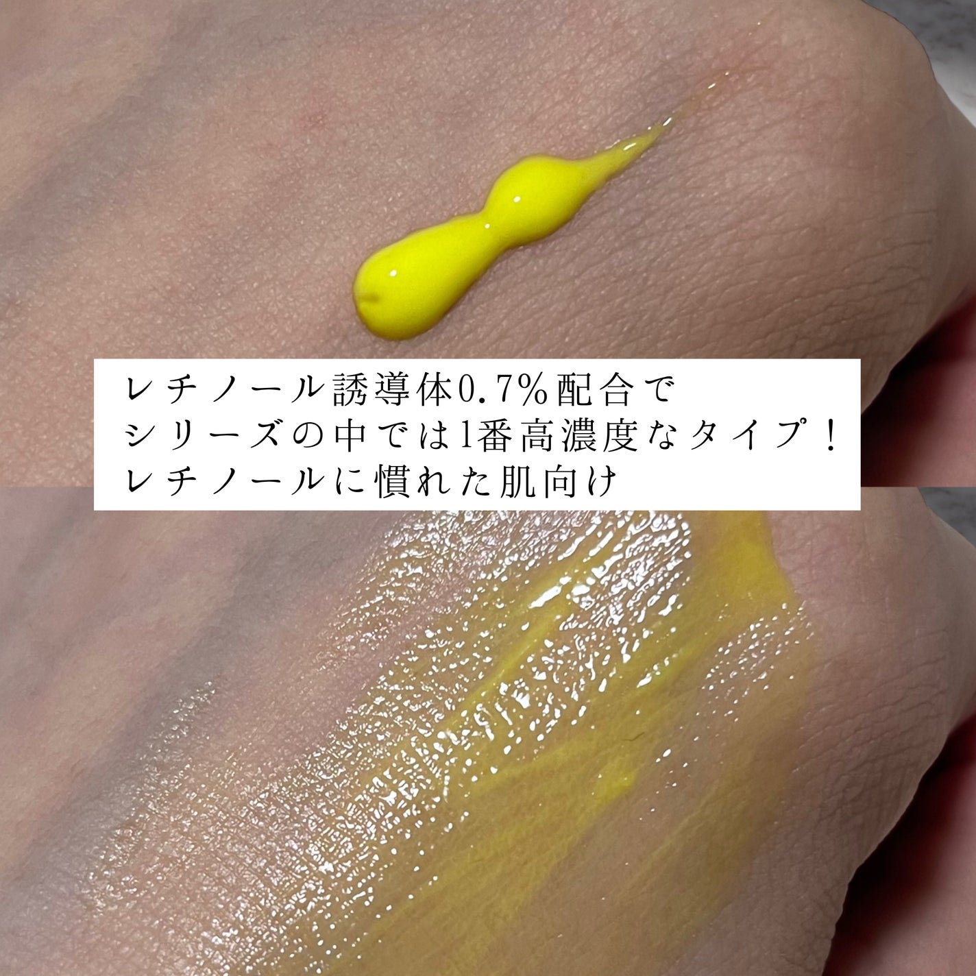 シカレチA エッセンス0.7/VT/美容液を使ったクチコミ(3枚目)