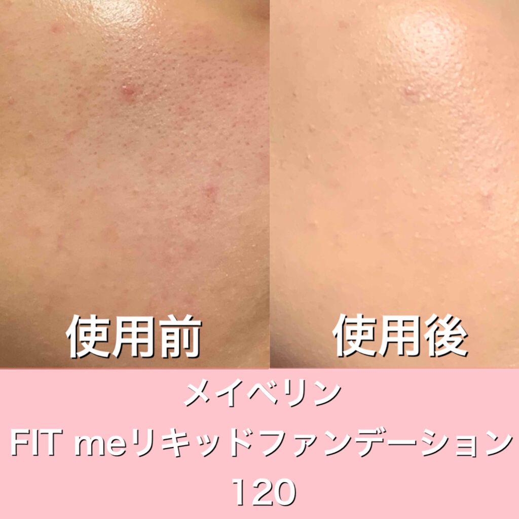 フィットミー リキッドファンデーション R/MAYBELLINE NEW YORK/リキッドファンデーションを使ったクチコミ（1枚目）