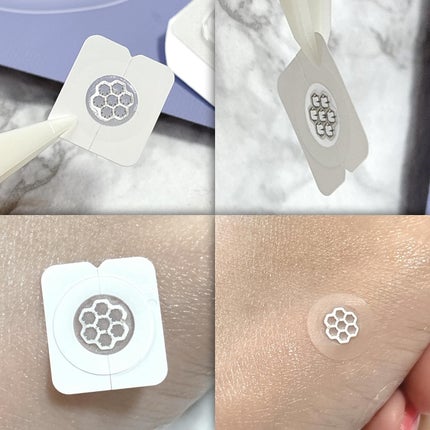 リアルカーミング/イージーダムビューティー/にきびパッチを使ったクチコミ(5枚目)