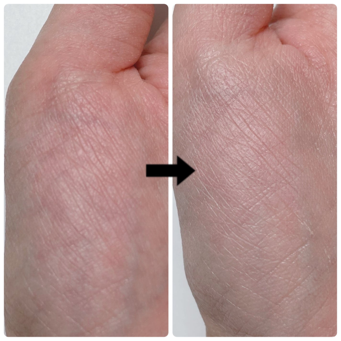 V3 ブリリアント ファンデーション/SPICARE/クッションファンデーションを使ったクチコミ(6枚目)