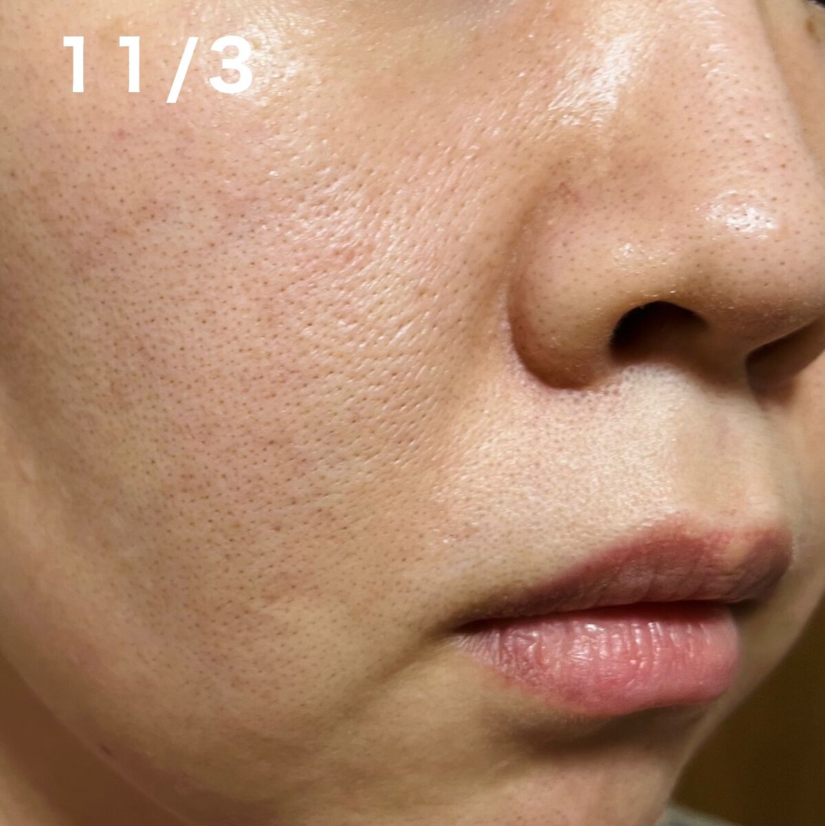 ザ・タイムR アクア/IPSA/化粧水を使ったクチコミ(2枚目)