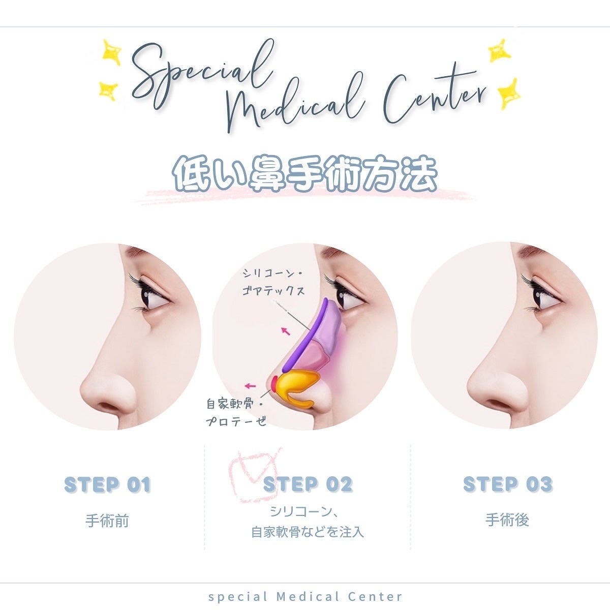 ユリナ on LIPS 「✎﹏韓国美容外科どこに行けばいいか分からない〜!って方必見😳✨..」(4枚目)