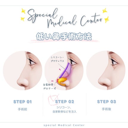 ユリナ on LIPS 「✎﹏韓国美容外科どこに行けばいいか分からない〜!って方必見😳✨..」(4枚目)