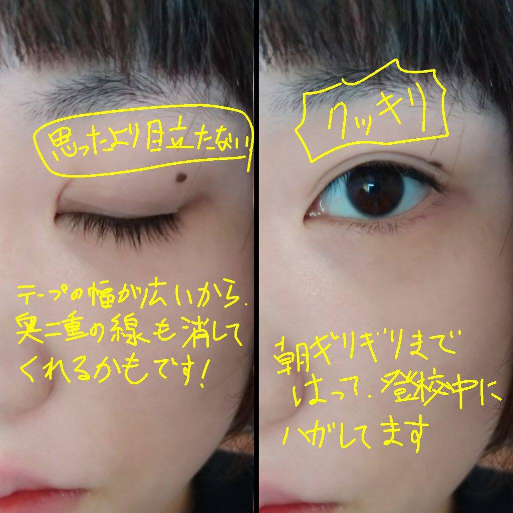 理想のふたえ ぱっちり幅広 ヌーディーワイド/セリア/二重まぶた用アイテムを使ったクチコミ(3枚目)