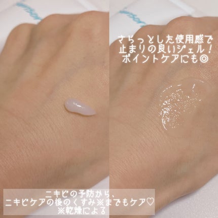 スキンピールバー ティートゥリー/サンソリット/洗顔石鹸を使ったクチコミ(8枚目)