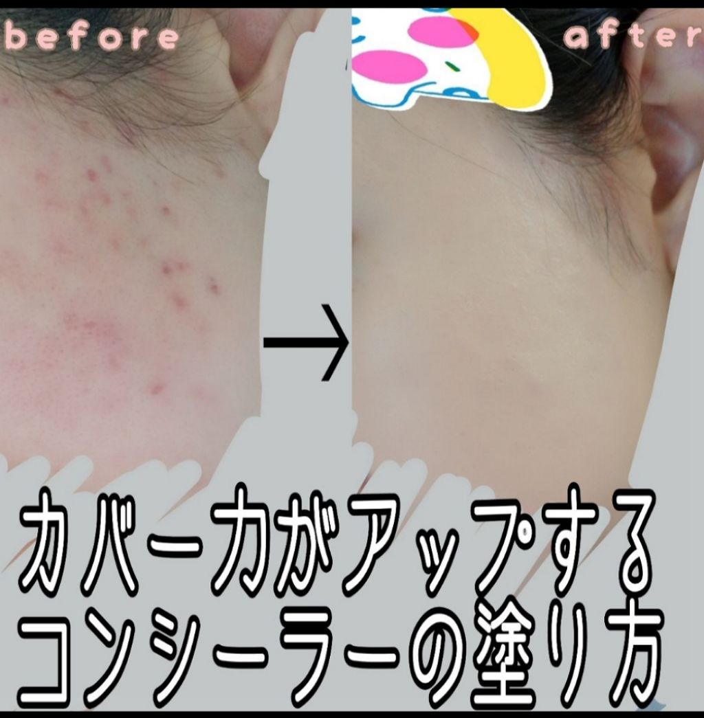 再アップ企画です！
この方法は本当に助かりまくってるので
ほんとおすすめです😂

汚肌失礼🙇💦
コンシーラーで全てを隠せ❣️❣️

コンシーラー難民の方いらっしゃいませ🙏

画像1、画像2は
コンシーラーのみ塗ってるもので無加工です