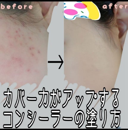 カバーパーフェクション チップコンシーラー/the SAEM/リキッドコンシーラーを使ったクチコミ(1枚目)