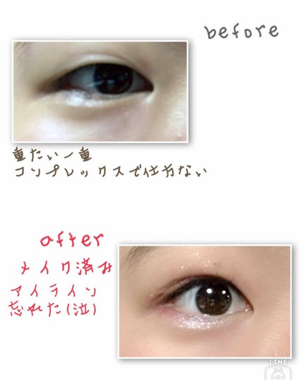 アイトーク/アイトーク/二重まぶた用アイテムを使ったクチコミ(2枚目)