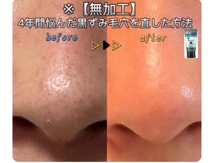 ハトムギ化粧水(ナチュリエ スキンコンディショナー R )/ナチュリエ/化粧水を使ったクチコミ(1枚目)